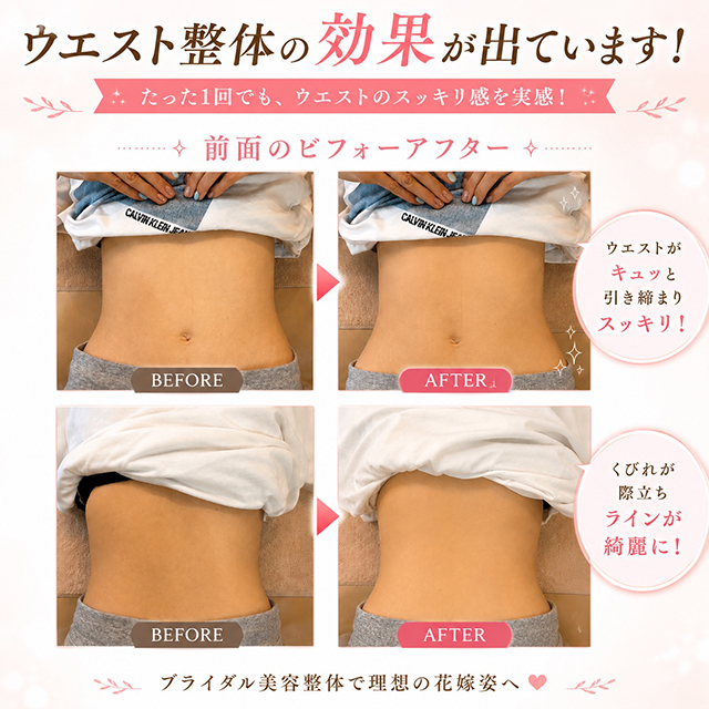 大阪梅田の美容整体 ビフォーアフター01