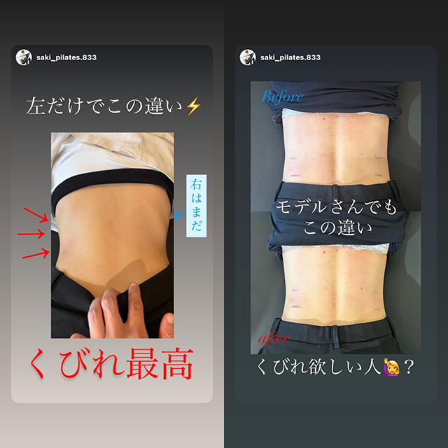 大阪梅田の美容整体 ビフォーアフター02