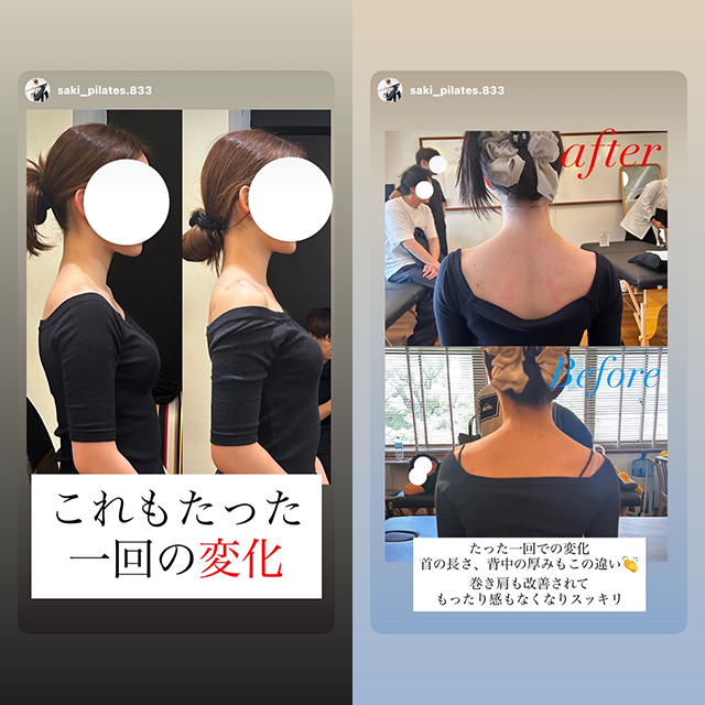 大阪梅田の美容整体 ビフォーアフター03
